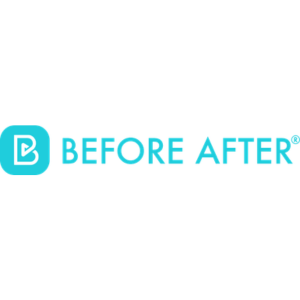 BEFORE AFTER
